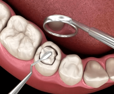 Best Invisalign Provider & Dental Clinics In BTM